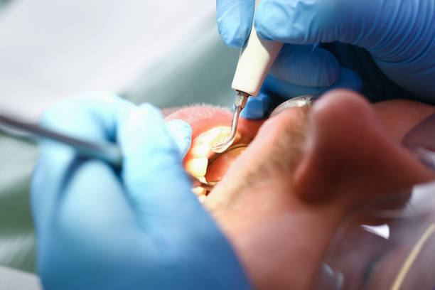Best 24-Hour Emergency Dental Care in Hopewell, VA