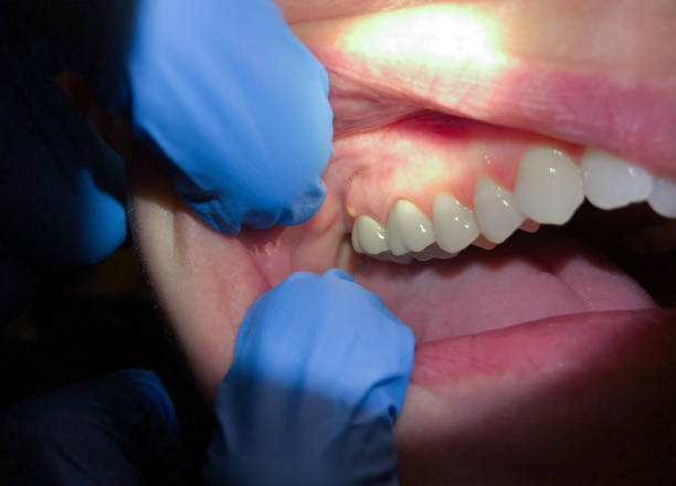Best 24-Hour Emergency Dental Care in Hopewell, VA