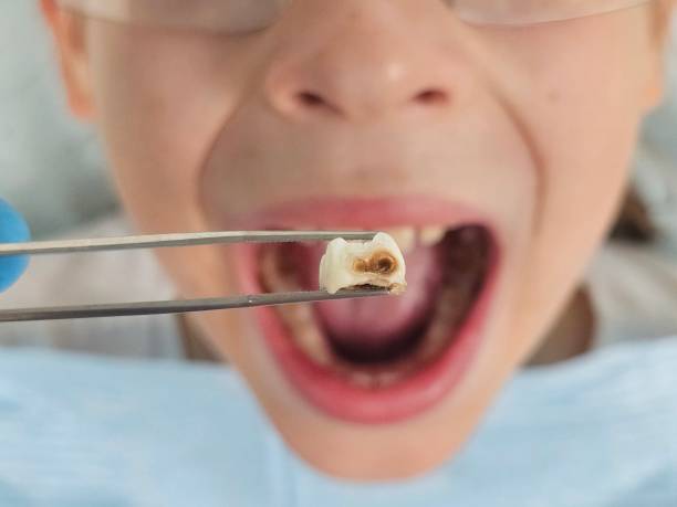 Best Emergency Orthodontic Repairs in Hopewell, VA