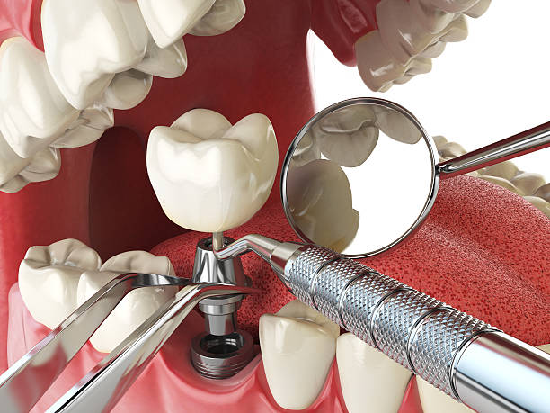 Best Weekend Emergency Dental Services in Hopewell, VA